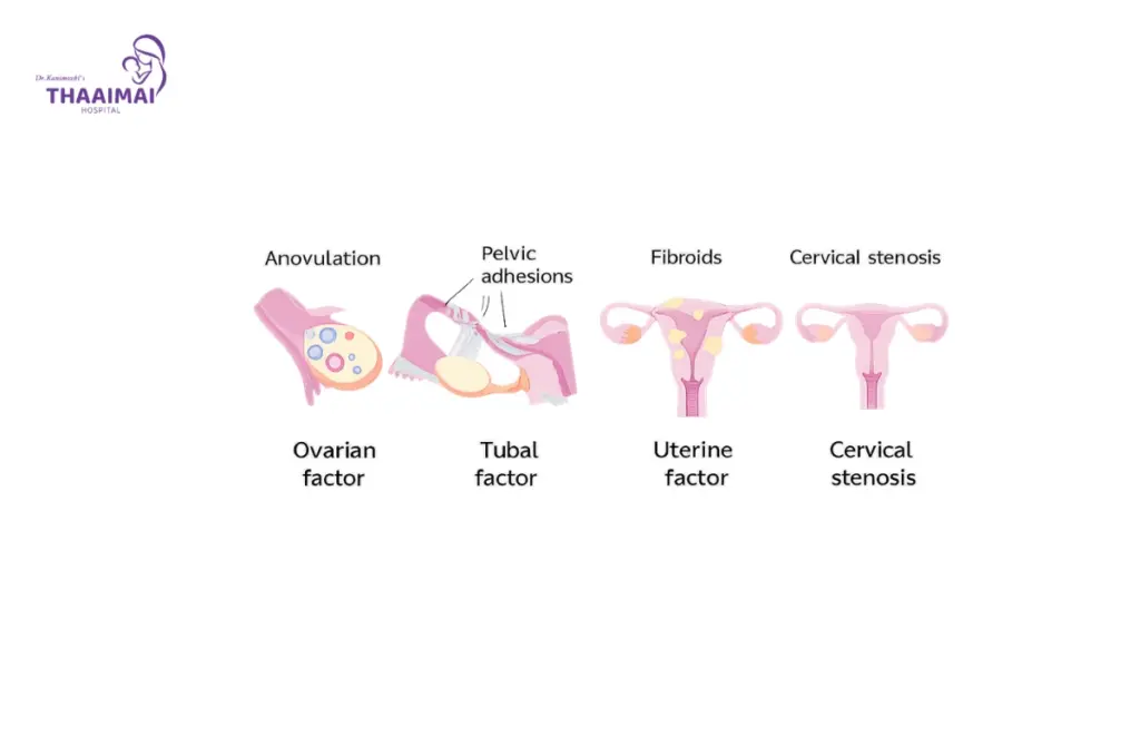 Difference Between PCOS and PCOD